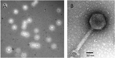 Therapeutic Potential of a New Jumbo Phage That Infects Vibrio coralliilyticus, a Widespread Coral Pathogen